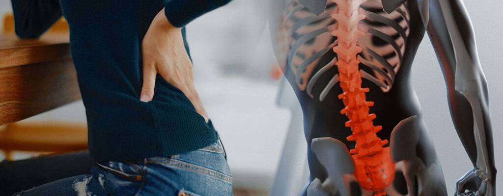Herniated Discs
